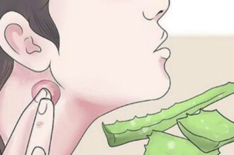 Do Not Be Afraid Of Cysts, You Can Eliminate Them With These Remedies