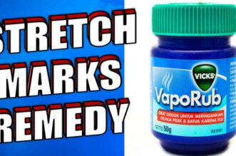 12 Different Ways To Use Vick's VapoRub That Now You Will Put Into Practice