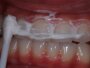 A Dentist Friend Told Me How To Eliminate Tartar, Gingivitis and Whiten My Teeth In 4 Steps With This Homemade Recipe