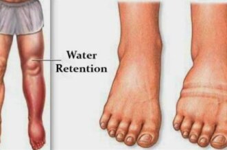 water retention