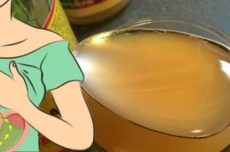 Apple Cider Vinegar