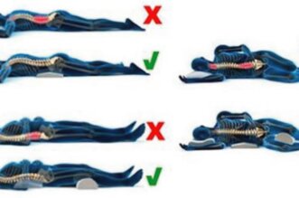 Back Pain