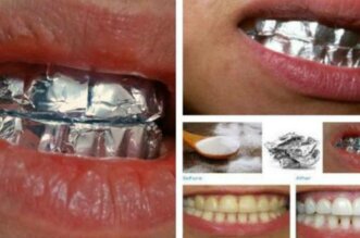 Aluminum Foil
