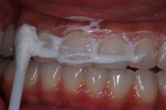 Oral health