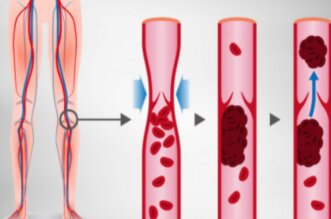 arteries